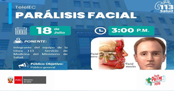  Capacitación online "Parálisis facial" del MINSA