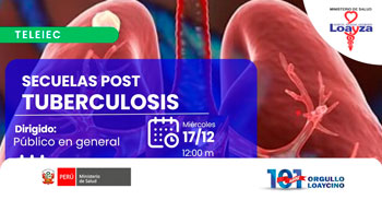  Capacitación online "Prevención de caries" del Hospital Nacional Arzobispo Loayza