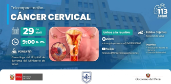  Capacitación online- "Cáncer cervical" MINSA 